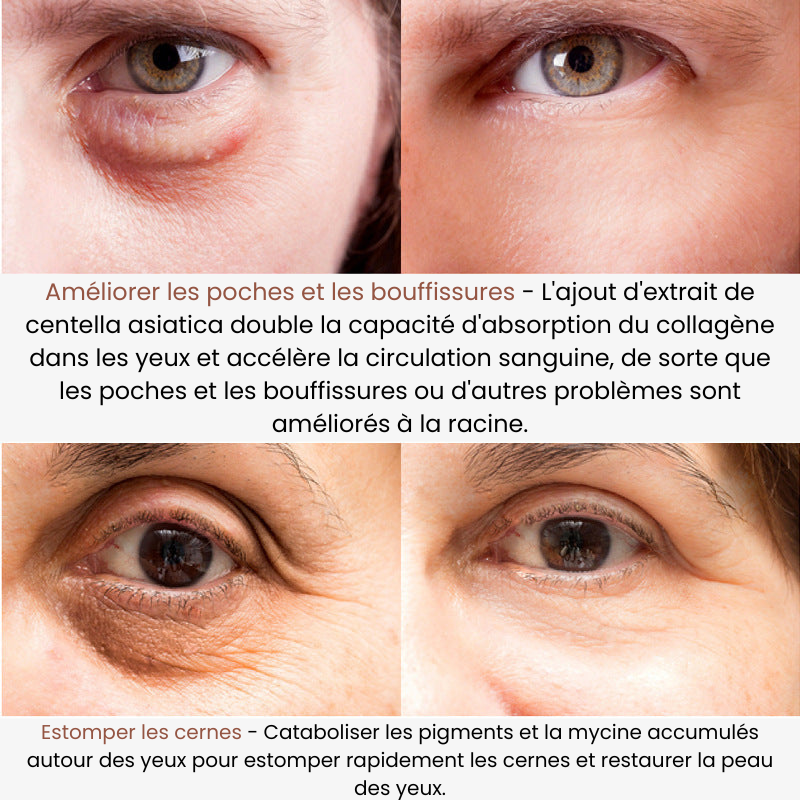 EyeShine™ - Feuchtigkeitsspendendes Augenpflege-Serum