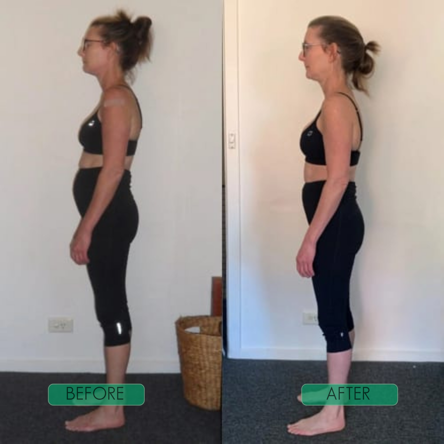 PosturaFlex™ | Instant posture correction