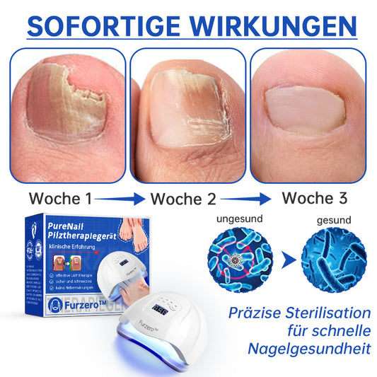 PureNail™ | Laser therapy device for nail fungus