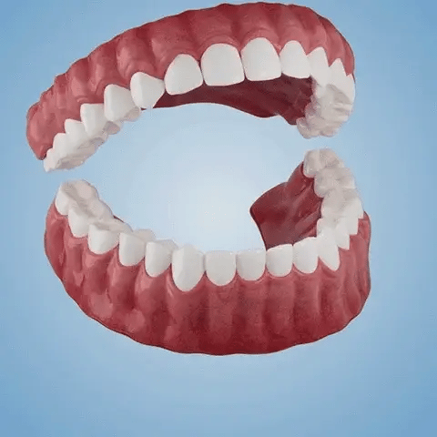 SmileShade – Versteckt schnell Zahnfehler für ein makelloses Lächeln