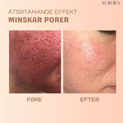 SkinSoothe – Glättet sofort Falten für einen jugendlichen Glanz