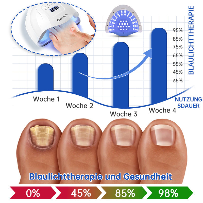 PureNail™ | Laser therapy device for nail fungus