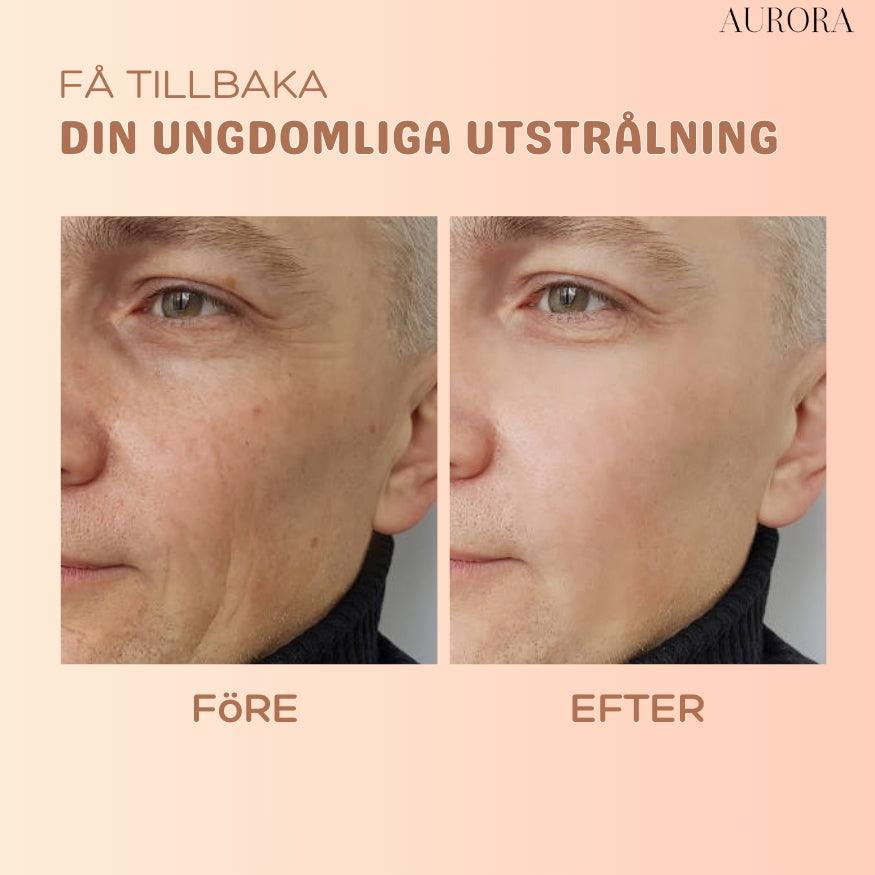 SkinSoothe – Glättet sofort Falten für einen jugendlichen Glanz