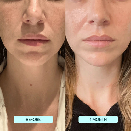 GlowSkin™ - Strahlkraft Steigerndes Gesichtsserum