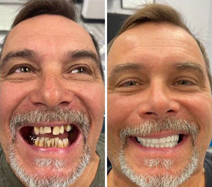 SmileShade – Versteckt schnell Zahnfehler für ein makelloses Lächeln