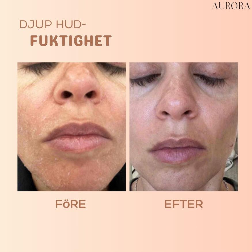 SkinSoothe – Glättet sofort Falten für einen jugendlichen Glanz