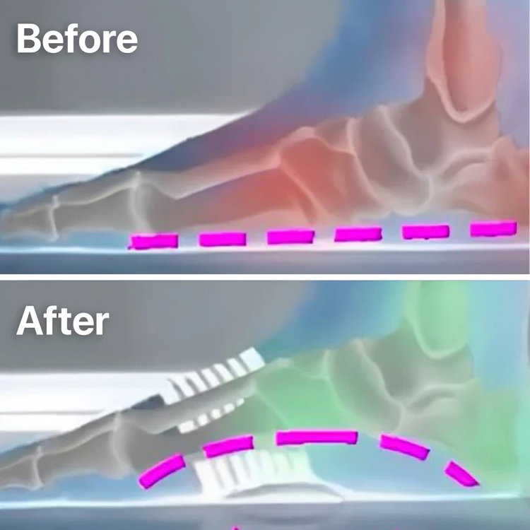StepRelief™ | Orthopedic Arch Support [1+1 Free] 