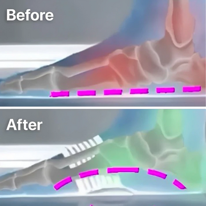 StepRelief™ | Orthopedic Arch Support [1+1 Free] 