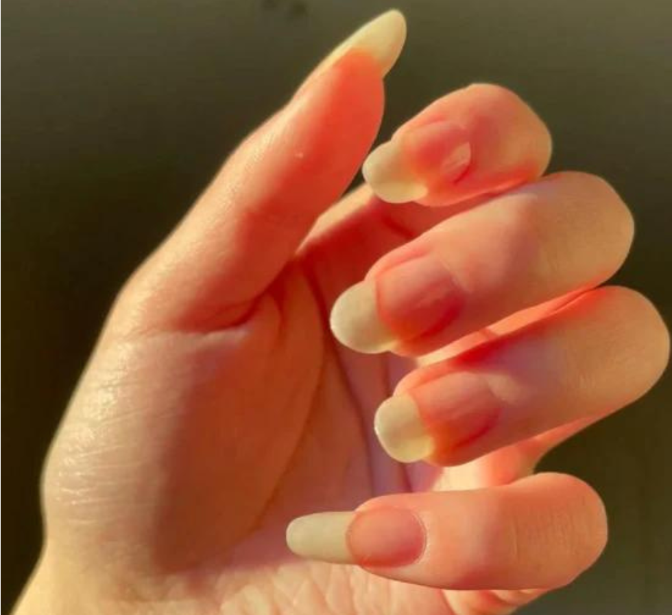 NailGlow™ | Nail Growth Serum 