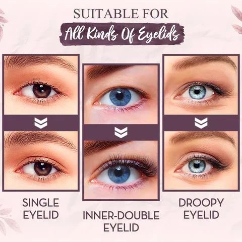 MagicLift™ | Eyelid Lift
