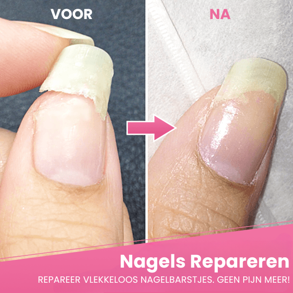 Reima™ | Repair gel for cracked nails