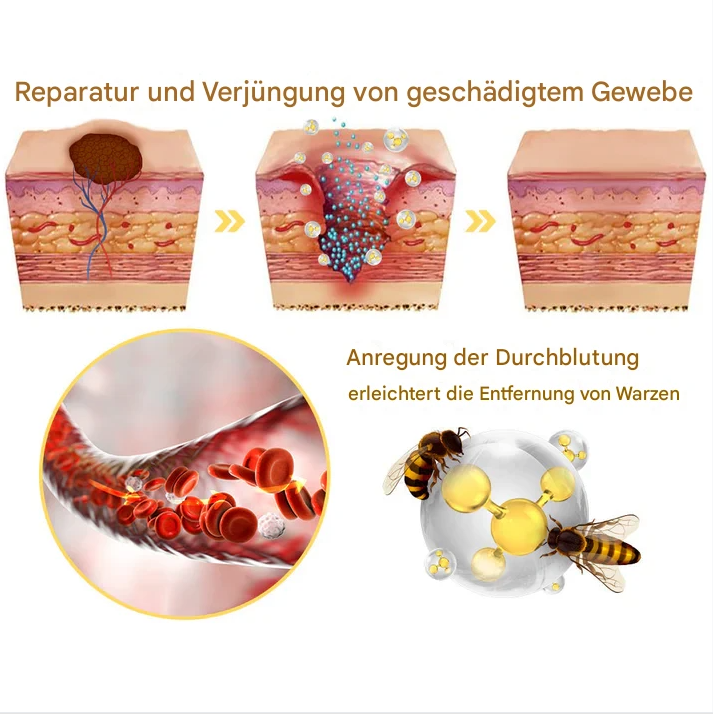 TagAway – Effektive Entfernung von Warzen und Hautwucherungen