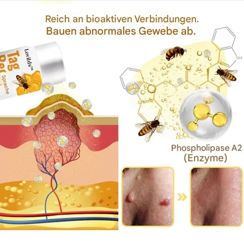 TagAway – Effektive Entfernung von Warzen und Hautwucherungen