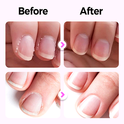 3-in-1 Nagelpflege-Stift für glatte und glänzende Nägel