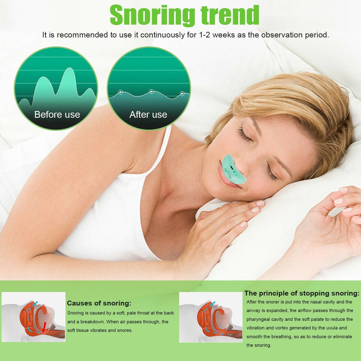 50% OFF | APROLO™ Mini Electric Anti-Snoring Device [Last Day Discount] 