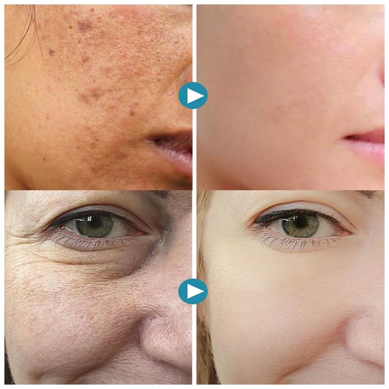 Silkrēa – Bietet sofortige Hautglättung für einen perfekten natürlichen Glow
