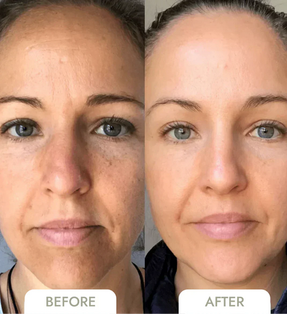 GlowSkin™ - Strahlkraft Steigerndes Gesichtsserum