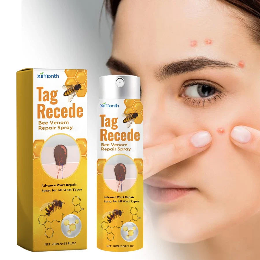 TagAway – Effektive Entfernung von Warzen und Hautwucherungen