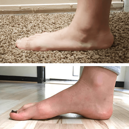 StepRelief™ | Orthopedic Arch Support [1+1 Free] 